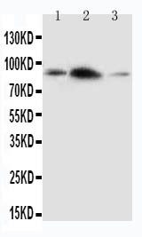 APLP2 Antibody - WB of APLP2 antibody. All lanes: Anti-APLP2 at 0.5ug/ml. Lane 1: Rat Brain Tissue Lysate at 40ug. Lane 2: Rat Heart Tissue Lysate at 40ug. Lane 3: SMMC Whole Cell Lysate at 40ug. Predicted bind size: 87KD. Observed bind size: 87KD.