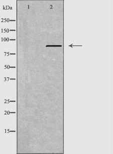 APLP2 Antibody - Western blot analysis of extracts of A549 cells using APLP2 antibody. The lane on the left is treated with the antigen-specific peptide.