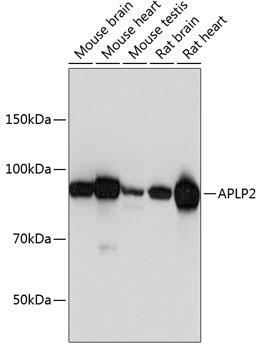 APLP2 Antibody - Western blot analysis of extracts of various cell lines using APLP2 Polyclonal Antibody at dilution of 1:1000.