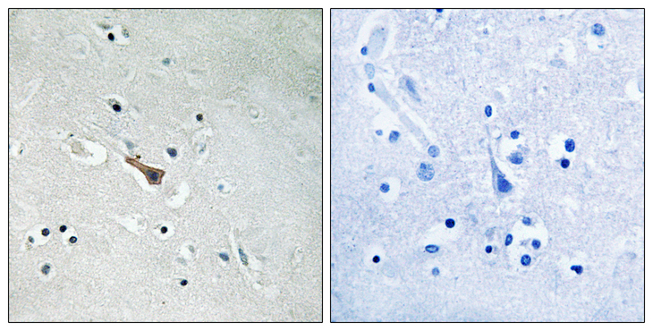 APLP2 Antibody - Immunohistochemistry analysis of paraffin-embedded human brain, using APLP2 (Phospho-Tyr755) Antibody. The picture on the right is blocked with the phospho peptide.