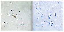 APLP2 Antibody - Immunohistochemistry analysis of paraffin-embedded human brain, using APLP2 (Phospho-Tyr755) Antibody. The picture on the right is blocked with the phospho peptide.