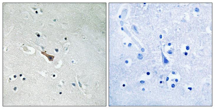 APLP2 Antibody - P-peptide - + Immunohistochemistry analysis of paraffin-embedded human brain tissue using APLP2 (Phospho-Tyr755) antibody. APLP2 (Phospho-Tyr755) antibody reacts with epitope-specific phosphopeptide and corresponding non-phosphopeptide.