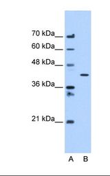 APMAP / C20orf3 Antibody - Lane A: Marker. Lane B: HepG2 cell lysate. Antibody concentration: 1.25 ug/ml. Gel concentration: 12%.  This image was taken for the unconjugated form of this product. Other forms have not been tested.