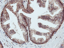 APMAP / C20orf3 Antibody - IHC of paraffin-embedded Human prostate tissue using anti-C20orf3 mouse monoclonal antibody.