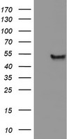 APMAP / C20orf3 Antibody - HEK293T cells were transfected with the pCMV6-ENTRY control (Left lane) or pCMV6-ENTRY C20orf3 (Right lane) cDNA for 48 hrs and lysed. Equivalent amounts of cell lysates (5 ug per lane) were separated by SDS-PAGE and immunoblotted with anti-C20orf3.