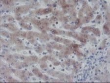 APMAP / C20orf3 Antibody - IHC of paraffin-embedded Human liver tissue using anti-C20orf3 mouse monoclonal antibody. (Heat-induced epitope retrieval by 10mM citric buffer, pH6.0, 100C for 10min).