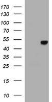 APMAP / C20orf3 Antibody - HEK293T cells were transfected with the pCMV6-ENTRY control (Left lane) or pCMV6-ENTRY C20orf3 (Right lane) cDNA for 48 hrs and lysed. Equivalent amounts of cell lysates (5 ug per lane) were separated by SDS-PAGE and immunoblotted with anti-C20orf3.