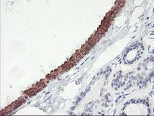 APMAP / C20orf3 Antibody - IHC of paraffin-embedded Human breast tissue using anti-C20orf3 mouse monoclonal antibody.