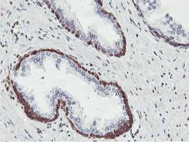 APMAP / C20orf3 Antibody - IHC of paraffin-embedded Human prostate tissue using anti-C20orf3 mouse monoclonal antibody.