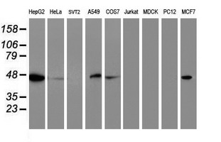 APMAP / C20orf3 Antibody - Western blot of extracts (35 ug) from 9 different cell lines by using anti-C20orf3 monoclonal antibody.