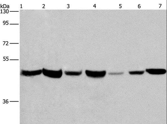 APMAP / C20orf3 Antibody - Western blot analysis of Human placenta and fetal liver tissue, PC3, 231, HeLa, HepG2 and A549 cell, using APMAP Polyclonal Antibody at dilution of 1:300.