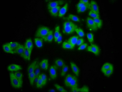 APMAP / C20orf3 Antibody - Immunofluorescence staining of HepG2 cells diluted at 1:133, counter-stained with DAPI. The cells were fixed in 4% formaldehyde, permeabilized using 0.2% Triton X-100 and blocked in 10% normal Goat Serum. The cells were then incubated with the antibody overnight at 4°C.The Secondary antibody was Alexa Fluor 488-congugated AffiniPure Goat Anti-Rabbit IgG (H+L).