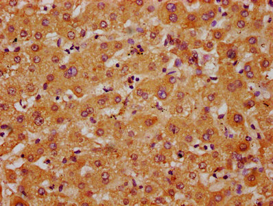 APMAP / C20orf3 Antibody - Immunohistochemistry Dilution at 1:400 and staining in paraffin-embedded human liver tissue performed on a Leica BondTM system. After dewaxing and hydration, antigen retrieval was mediated by high pressure in a citrate buffer (pH 6.0). Section was blocked with 10% normal Goat serum 30min at RT. Then primary antibody (1% BSA) was incubated at 4°C overnight. The primary is detected by a biotinylated Secondary antibody and visualized using an HRP conjugated SP system.