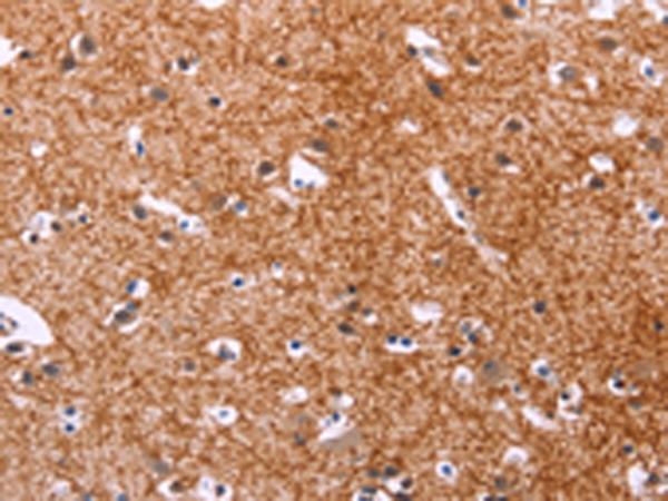 APMAP / C20orf3 Antibody - Immunohistochemistry of paraffin-embedded Human brain tissue  using APMAP Polyclonal Antibody at dilution of 1:30(×200)