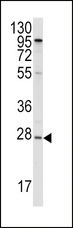 APOA1 / Apolipoprotein A 1 Antibody - Western blot of anti-APOA1 Antibody in HepG2 cell line lysates (35 ug/lane). APOA1(arrow) was detected using the purified antibody.