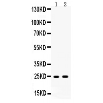 APOA1 / Apolipoprotein A 1 Antibody - Western blot analysis of Apolipoprotein A I expression in rat liver extract (lane 1) and rat testis extract (lane 2). Apolipoprotein A I at 24 kD was detected using rabbit anti- Apolipoprotein A I Antigen Affinity purified polyclonal antibody at 0.5 ug/mL. The blot was developed using chemiluminescence (ECL) method.