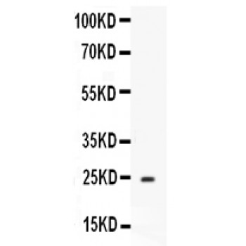 APOA1 / Apolipoprotein A 1 Antibody - Western blot analysis of Apolipoprotein A I expression in Mouse Liver extract (lane 1). Apolipoprotein A I at 24 kD was detected using rabbit anti- Apolipoprotein A I Antigen Affinity purified polyclonal antibody at 0.5 ug/mL. The blot was developed using chemiluminescence (ECL) method.