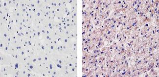 APOA1 / Apolipoprotein A 1 Antibody - Apolipoprotein A-1 Immunohistochemistry