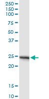 APOA1 / Apolipoprotein A 1 Antibody - APOA1 monoclonal antibody (M01), clone 3A11-1A9. Western Blot analysis of APOA1 expression in human kidney.
