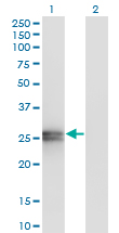 APOA1 / Apolipoprotein A 1 Antibody - Western Blot analysis of APOA1 expression in transfected 293T cell line by APOA1 monoclonal antibody (M01), clone 3A11-1A9.Lane 1: APOA1 transfected lysate (Predicted MW: 30.8 KDa).Lane 2: Non-transfected lysate.