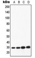 APOA1 / Apolipoprotein A 1 Antibody - Western blot analysis of Apolipoprotein A1 expression in HepG2 (A); HeLa (B); mouse heart (C); rat heart (D) whole cell lysates.