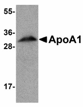 APOA1 / Apolipoprotein A 1 Antibody - Western blot of ApoA1 in human liver tissue lysate with ApoA1 antibody at 1 ug/ml. Below: Immunofluorescence of ApoA1 in human liver tissue with ApoA1 antibody at 20 ug/ml.