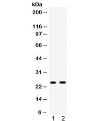 APOA1 / Apolipoprotein A 1 Antibody