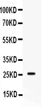 APOA1 / Apolipoprotein A 1 Antibody - Western blot - Anti-APOA1/Apoa I Picoband Antibody