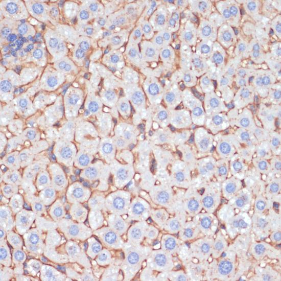 APOA1 / Apolipoprotein A 1 Antibody - Immunohistochemistry of paraffin-embedded Mouse liver using APOA1 Polyclonal Antibody at dilution of 1:100 (40x lens).