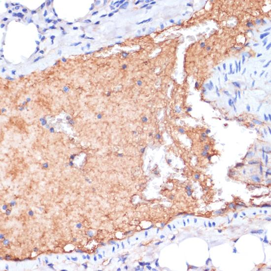 APOA1 / Apolipoprotein A 1 Antibody - Immunohistochemistry of paraffin-embedded Mouse lung using APOA1 Polyclonal Antibody at dilution of 1:100 (40x lens).