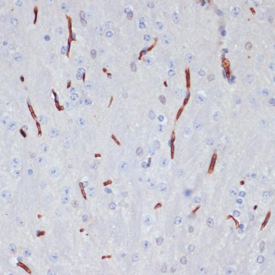 APOA1 / Apolipoprotein A 1 Antibody - Immunohistochemistry of paraffin-embedded Mouse brain using APOA1 Polyclonal Antibody at dilution of 1:100 (40x lens).