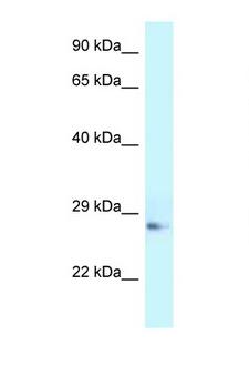 APOA1 / Apolipoprotein A 1 Antibody - APOA1 / APOAI antibody Western blot of Rat Muscle lysate. Antibody concentration 1 ug/ml.  This image was taken for the unconjugated form of this product. Other forms have not been tested.