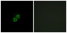 APOA1BP Antibody - Immunofluorescence analysis of A549 cells, using AIBP Antibody. The picture on the right is blocked with the synthesized peptide.
