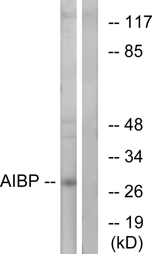 APOA1BP Antibody - Western blot analysis of lysates from HeLa cells, using AIBP Antibody. The lane on the right is blocked with the synthesized peptide.