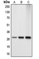 APOA1BP Antibody - Western blot analysis of APOA1BP expression in HEK293T (A); mouse kidney (B); rat kidney (C) whole cell lysates.