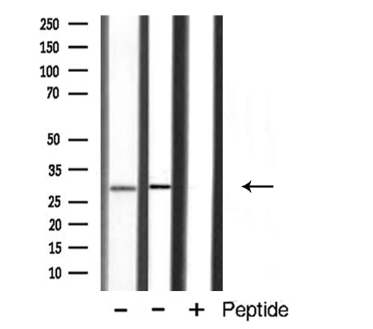 APOA1BP Antibody - Western blot analysis of extracts of various samples using AIBP antibody