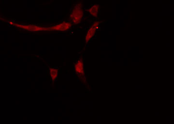 APOA1BP Antibody - Staining HeLa cells by IF/ICC. The samples were fixed with PFA and permeabilized in 0.1% Triton X-100, then blocked in 10% serum for 45 min at 25°C. The primary antibody was diluted at 1:200 and incubated with the sample for 1 hour at 37°C. An Alexa Fluor 594 conjugated goat anti-rabbit IgG (H+L) antibody, diluted at 1/600, was used as secondary antibody.