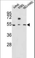 APOA4 Antibody - Western blot of APOA4 Antibody in Jurkat, K562, NCI-H460 cell line lysates (35 ug/lane). APOA4 (arrow) was detected using the purified antibody.