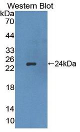 APOB / Apolipoprotein B Antibody - Western Blot; Sample: Recombinant protein.