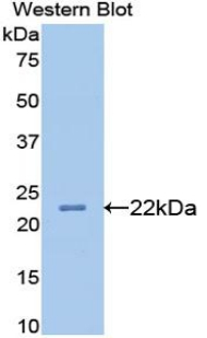 APOB / Apolipoprotein B Antibody - Western blot of recombinant Apolipoprotein B / APOB.  This image was taken for the unconjugated form of this product. Other forms have not been tested.