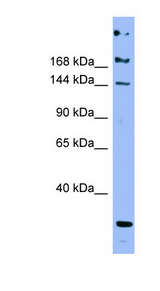 APOB / Apolipoprotein B Antibody - APOB / Apolipoprotein B antibody Western blot of Fetal Stomach lysate. This image was taken for the unconjugated form of this product. Other forms have not been tested.