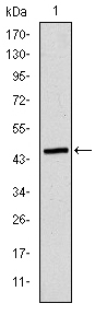 APOB / Apolipoprotein B Antibody - Western blot using ApoB monoclonal antibody against human ApoB (AA: 3900-4110) recombinant protein. (Expected MW is 45 kDa)