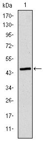 APOB / Apolipoprotein B Antibody - Apolipoprotein B Antibody in Western Blot (WB)