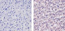 APOB / Apolipoprotein B Antibody - Immunohistochemistry analysis of Apolipoprotein B showing staining in the cytoplasm of paraffin-embedded human liver tissue (right) compared to a negative control without primary antibody (left). To expose target proteins, antigen retrieval was performed using 10mM sodium citrate (pH 6.0), microwaved for 8-15 min. Following antigen retrieval, tissues were blocked in 3% H2O2-methanol for 15 min at room temperature, washed with ddH2O and PBS, and then probed with a Apolipoprotein B Mouse Monoclonal Antibody diluted in 3% BSA-PBS at a dilution of 1:20 for 1 hour at 37ºC in a humidified chamber. Tissues were washed extensively in PBST and detection was performed using an HRP-conjugated secondary antibody followed by colorimetric detection using a DAB kit. Tissues were counterstained with hematoxylin and dehydrated with ethanol and xylene to prep for mounting.