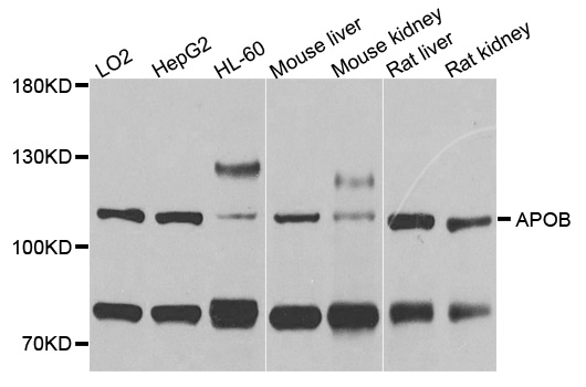 APOB / Apolipoprotein B Antibody - Western blot analysis of extracts of various cell lines, using APOB antibody at 1:1000 dilution. The secondary antibody used was an HRP Goat Anti-Rabbit IgG (H+L) at 1:10000 dilution. Lysates were loaded 25ug per lane and 3% nonfat dry milk in TBST was used for blocking. An ECL Kit was used for detection and the exposure time was 60s.