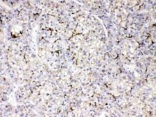 APOB / Apolipoprotein B Antibody - IHC testing of FFPE human liver with APOB antibody at 1ug/ml. HIER: steam sections in pH6 citrate buffer for 20 min.