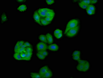 APOBEC1 Antibody - Immunofluorescence staining of HepG2 cells at a dilution of 1:66, counter-stained with DAPI. The cells were fixed in 4% formaldehyde, permeabilized using 0.2% Triton X-100 and blocked in 10% normal Goat Serum. The cells were then incubated with the antibody overnight at 4 °C.The secondary antibody was Alexa Fluor 488-congugated AffiniPure Goat Anti-Rabbit IgG (H+L) .