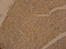 APOBEC2 Antibody - APOBEC2 Antibody immunohistochemistry of formalin-fixed and paraffin-embedded mouse heart tissue followed by peroxidase-conjugated secondary antibody and DAB staining.