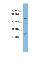 APOBEC2 Antibody - APOBEC2 antibody Western blot of COLO205 cell lysate. This image was taken for the unconjugated form of this product. Other forms have not been tested.