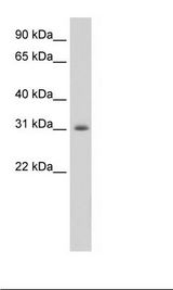 APOBEC2 Antibody - Fetal muscle Lysate.  This image was taken for the unconjugated form of this product. Other forms have not been tested.
